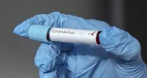 GUINEE- COVID19: L’ANSS FERA DESORMAIS DES TESTS POUR TOUS LES CAS DE DÉCÈS MEME A DOMICILE…