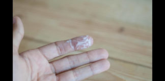 SANTE : TOUT SAVOIR SUR LES PERTES BLANCHES !