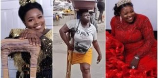 UNE VENDEUSE D’EAU AMPUTÉE DU PIED DEVIENT STAR…