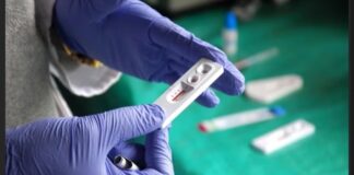 LA GUINÉE COMPTE 113.000 PERSONNES VIVANT AVEC LE VIH (CNLS)