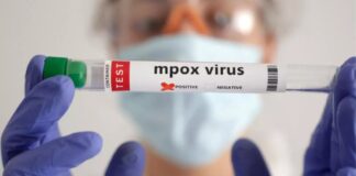 VIRUS MPOX EN SIERRA LEONE, LA GUINÉE EST-ELLE PROTÉGÉE?