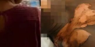 JALOUSIE CONJUGALE : UNE FEMME BRÛLE SON MARI