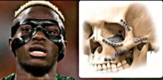 VOICI POURQUOI VICTOR OSIMHEN PORTE UN MASQUE ?